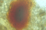 Blood meal Blood meal
